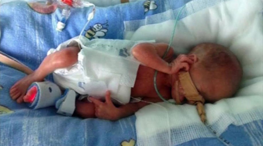 premature baby nappies