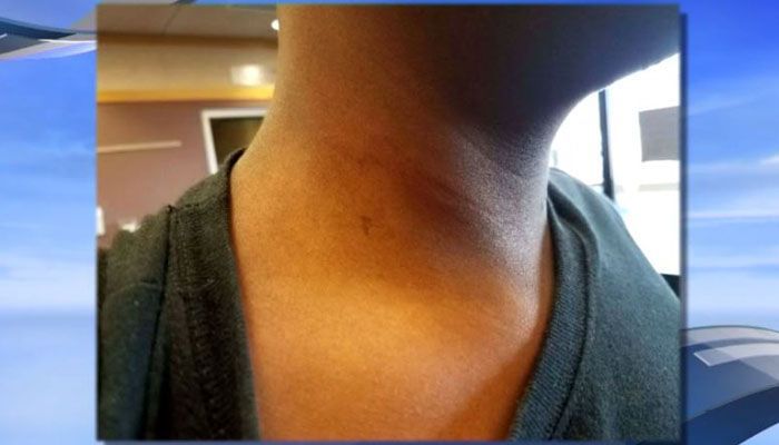 FOX19's tweet photo. Substitute teacher accused of choking 13-year-old student https://t.co/pBP8mRH3nR https://t.co/esOWuYV6mY