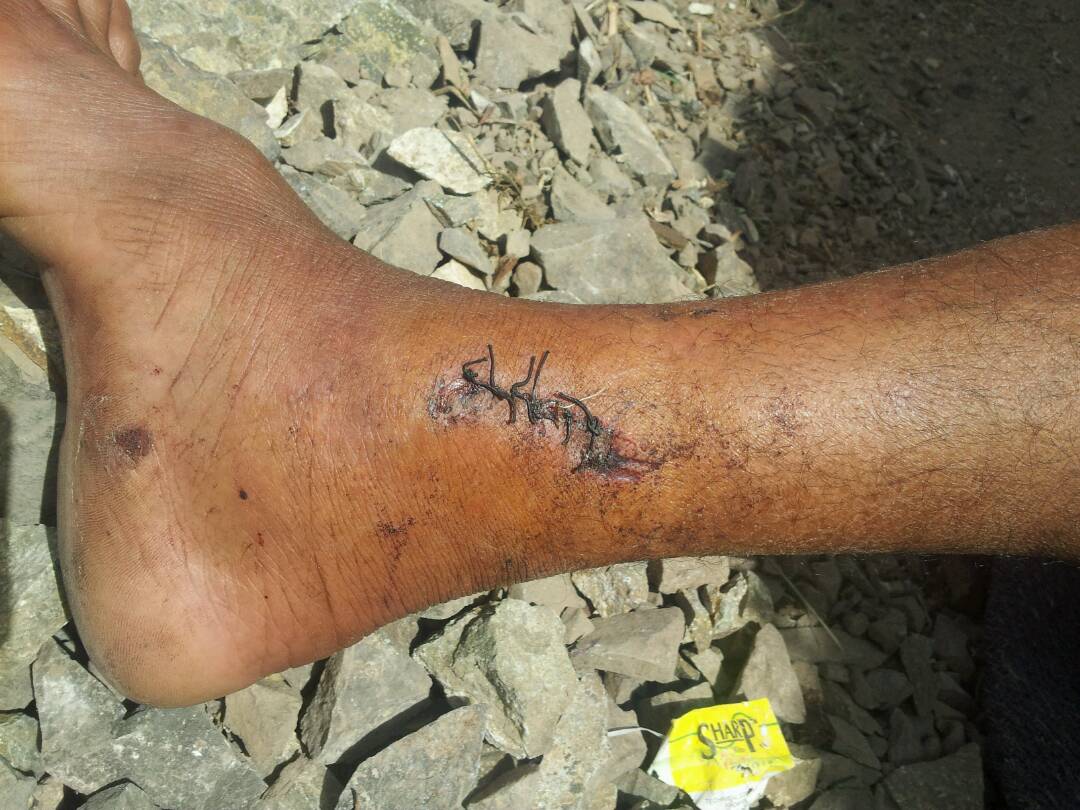 GuardTaiz's tweet photo. لن أعتذر عن عناقك ايتها التراب الطاهرة
للمرة الرابعة و الاصابات تلاحقني
لن أكون سوى في المكان الذي تريده تعز

#معا_نحو_النصر 
#تعز https://t.co/FBQ4ukau0d