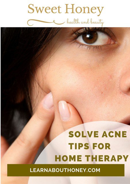 Tips for solving acne with Honey home therapy! crwd.fr/2oXBkuG #acne #cureacne #diy #homeremedy #honey #honeyforskin #pimples