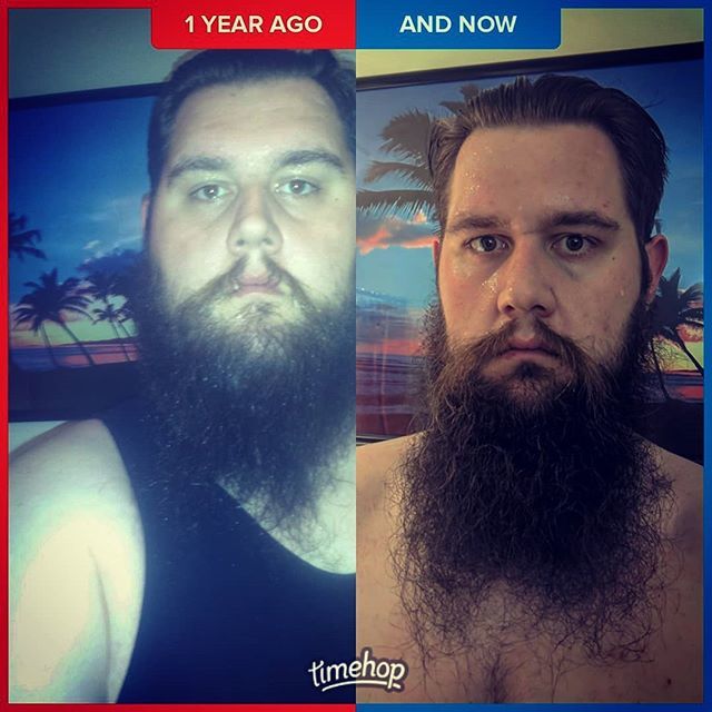 YeahWhatFun's tweet photo. These are gonna just keep getting better and better. #weightlossstory #weightlosstransformation #weightloss #1year #MadViking #beard #beardgrowth #beardsofinstagram #MentalAcuity #mentalclarity #NoTrainerNeeded #timehop #outtheshowerfresh #badassbarback … https://t.co/yIwhslrR3v https://t.co/8myE7wUktA