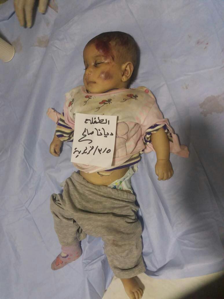 Hamedsh86's tweet photo. Just take a look at this photo, how turkey can bring peace and humanity??????#BreakSilenceOnAfrin https://t.co/9nh75owWSE
