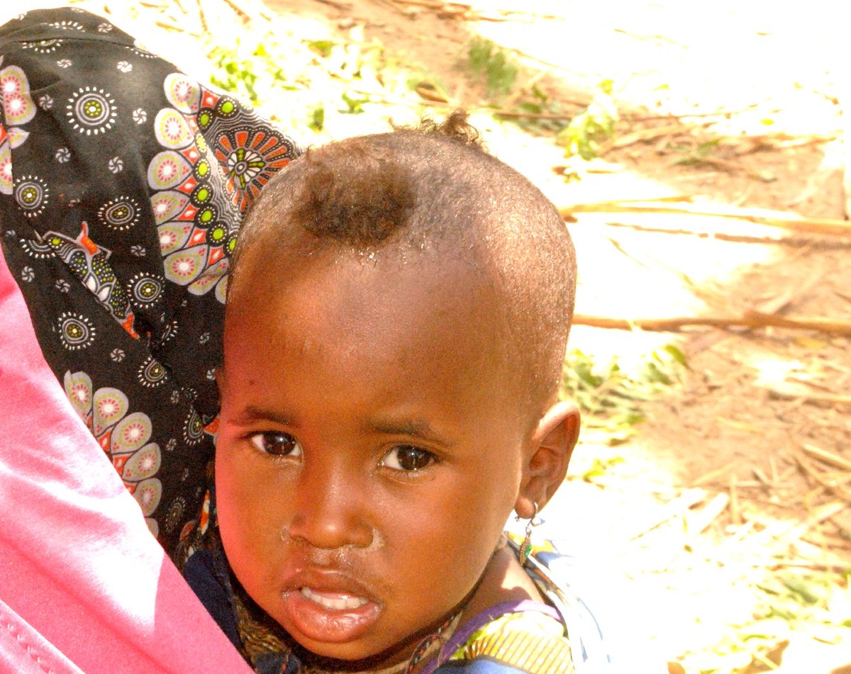 ShettimaDogo's tweet photo. One of the victim of #Musari and #Dusuman of #Jere LG Fire Outbreak .The people are Shuwa Arab by tribe in Borno . They will start a new life again. In spite no quality Education, Health Care services, portable drinking water @GovBorno @MBuhari @aishambuhari @NGRSenate @NePcni https://t.co/dsmDtiKhPb