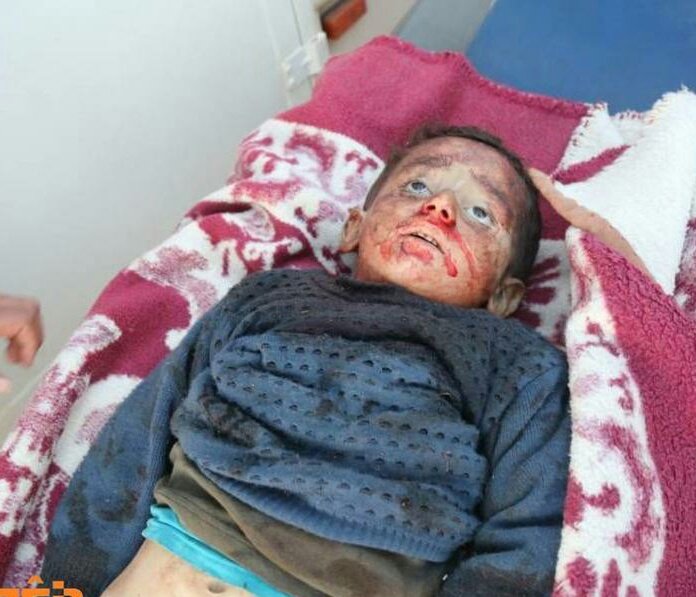 mahoor_anna's tweet photo. .

Turkey is a baby killer terrorist.

#BreakSilenceOnAfrin https://t.co/C36k5S7QVU