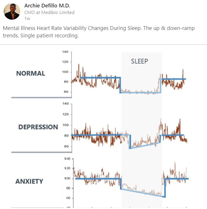 Sleeping Heart Rate Chart