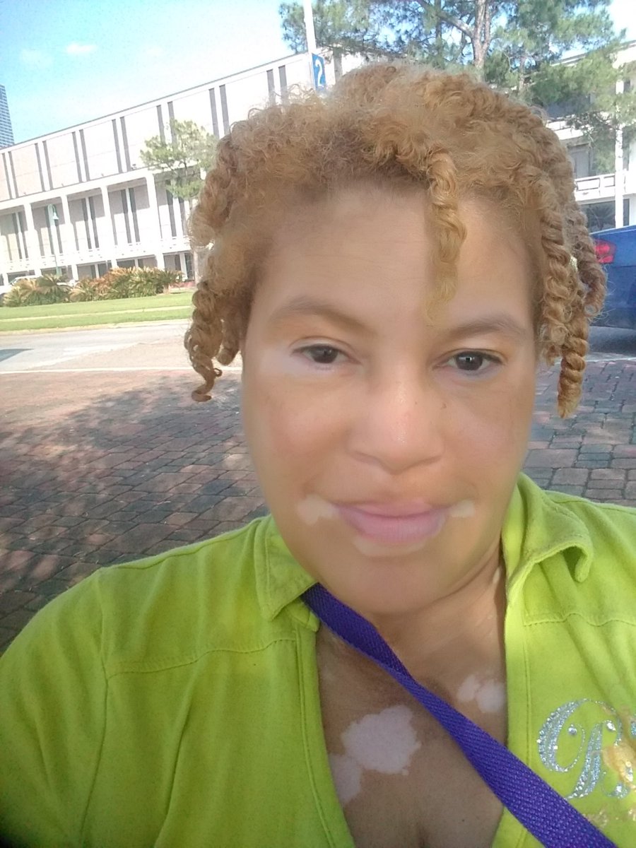 dapurplediva's tweet photo. when u don't hav..fam..r friends 2 hang out wit...do.....U...#vitiligo4life #aworldofourown #VITILIGOSTRONG embrace da skin I'm in #VITILIGOFAMILY #WEAREVITILIGANS #VITILIGOSTRONG #cantcuredopeskin NO makeup Natural HAIR 😏😏😏😏😏 https://t.co/xo55164ycn
