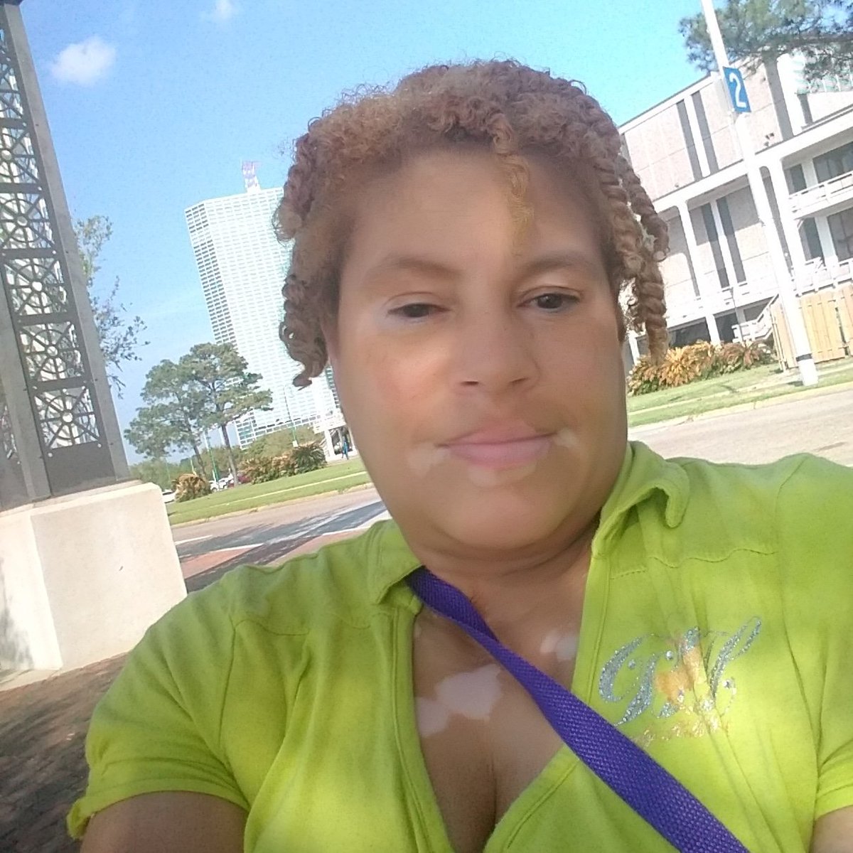 dapurplediva's tweet photo. when u don't hav..fam..r friends 2 hang out wit...do.....U...#vitiligo4life #aworldofourown #VITILIGOSTRONG embrace da skin I'm in #VITILIGOFAMILY #WEAREVITILIGANS #VITILIGOSTRONG #cantcuredopeskin NO makeup Natural HAIR 😏😏😏😏😏 https://t.co/xo55164ycn