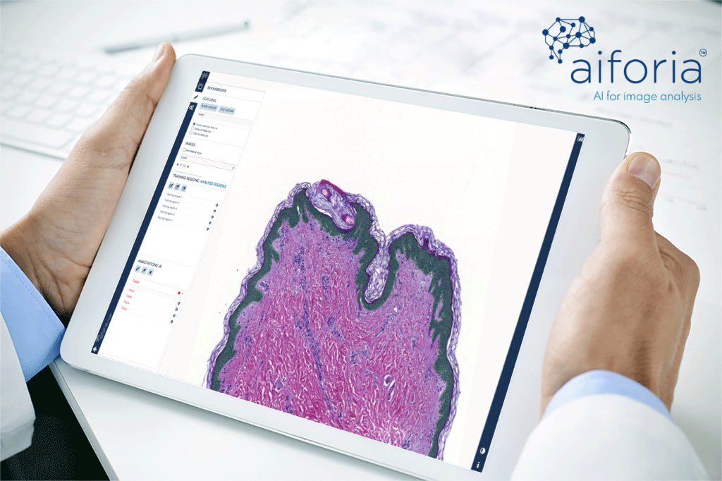 aiforia_tech's tweet photo. The Exhibition opens tomorrow! Come see our new Aiforia Create and how you can create deep learning AI algorithms yourself! #booth833 #aiforia #USCAP2018 https://t.co/YfB8iwpUt8