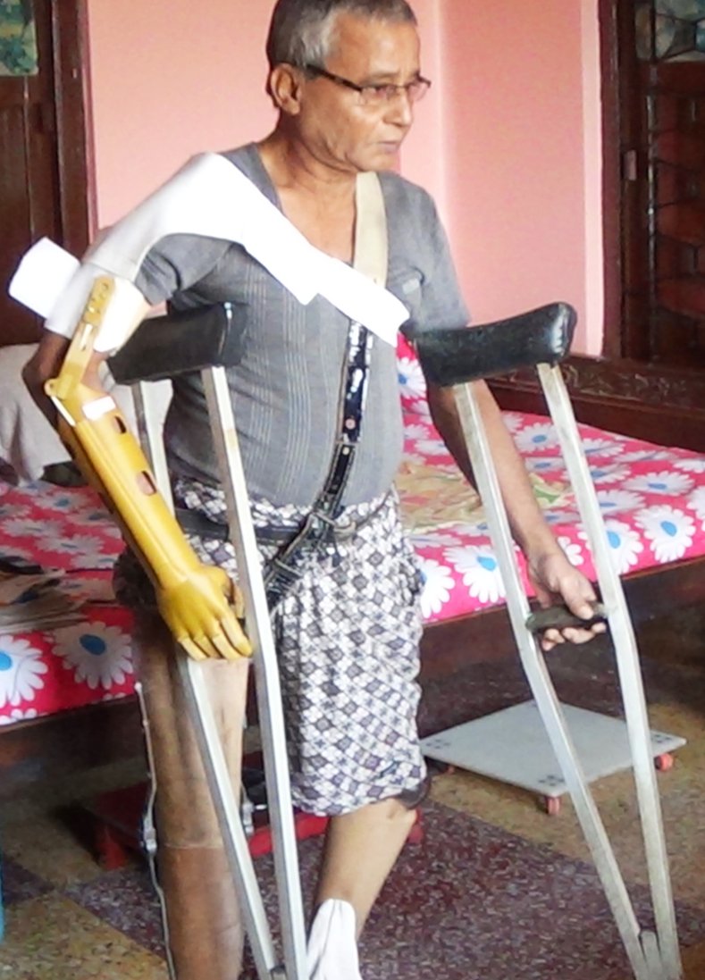 AnudipF's tweet image. @AnudipF 's 3D Printing for Development (3D4D) offers low-cost, lightweight, customized, 3D-printed prosthetics to needy amputees from slums and villages. Learn more about Anudip Foundation's 3D4D at anudip.org/offerings/3d4d/
#newskills #technologyfordevelopment #youth