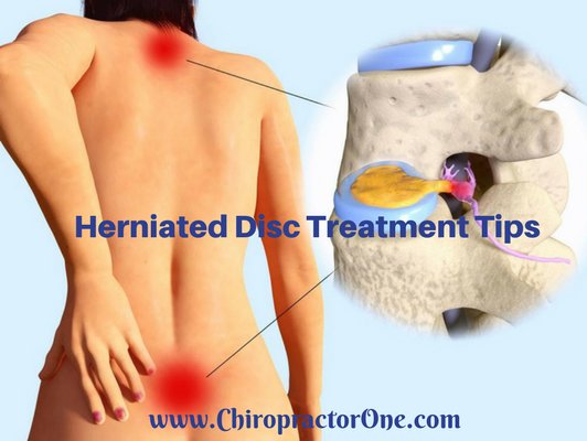 OneChiropractor's tweet photo. 5 #Herniated_Disc #Treatment Steps
1. Eat a #Collagen/#Bone Broth Diet
2. Consume Beneficial #Supplements
3. Practice #Egoscue
4. Get #Prolotherapy
5. Get Corrective #Chiropractic Care
https://t.co/tH0mrKP6Hr https://t.co/Vfsf38MkR6