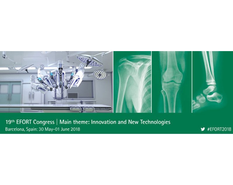 EFORTnet's tweet photo. #InstructionalLecture @ #EFORT2018 Congress in Barcelona by Prof. Gebhard from @Uni_Ulm on New Advances in #Intraoperative #Imaging on #Trauma will focus on current status #VisualizationTechniques during #FractureSurgery #EFORTote Join us &amp; do not miss it! https://t.co/LuvlzwBnq0 https://t.co/tMOWH3zv9g