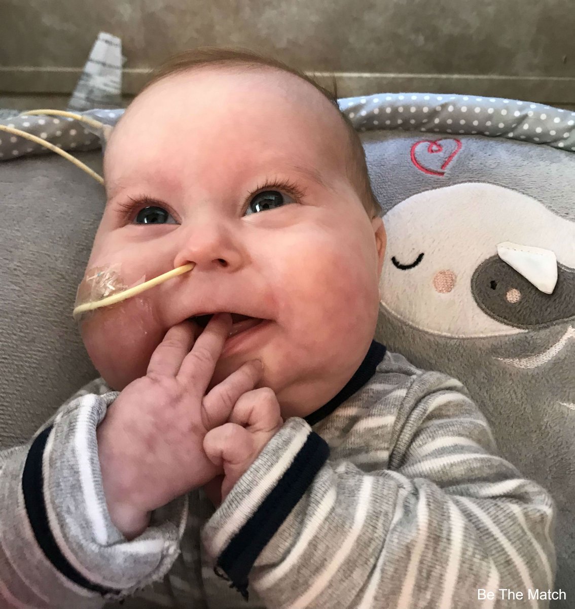 Bodfish baby in need of bone marrow transplant. puts out the plea for