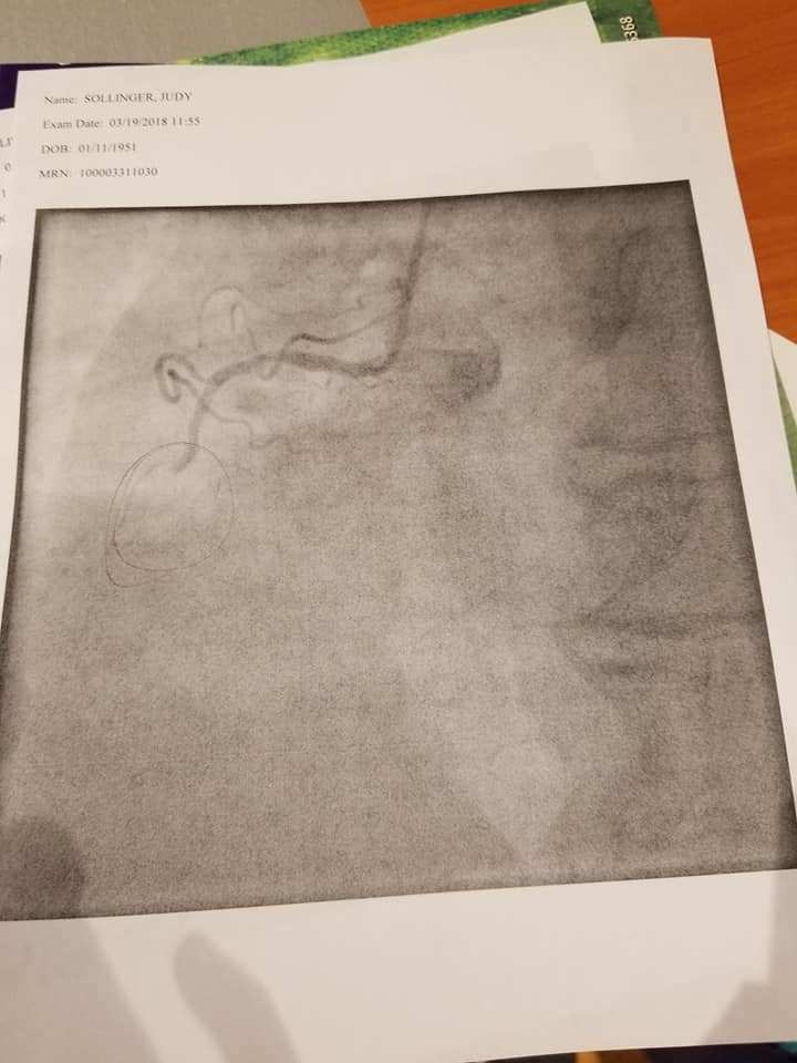 NotsoBride's tweet image. And she almost died. notsotraditionalbride.wordpress.com/2018/03/20/and…