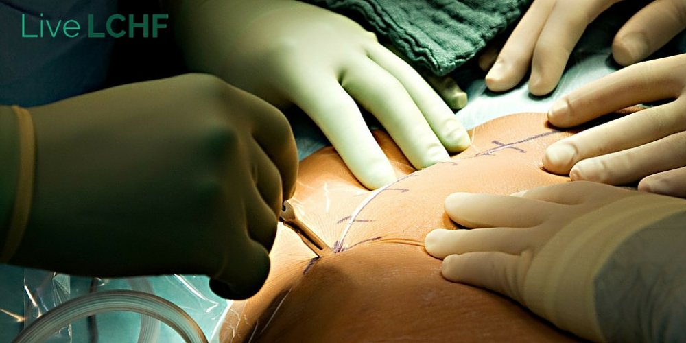 The LCHF Podcast tweet media