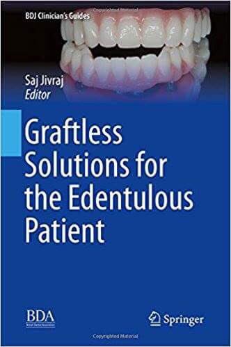 DawoodandTanner's tweet photo. @AndrewDawood &amp; Dr Tanner have contributed a chapter to author @anacapadental of ‘Graftless Solutions for the Edentulous Patient’ book designed to meet the needs of clinicians explaining the rationale &amp; technique for the rehabilitation of fully edentulous patients #edentulous https://t.co/V8L8vEAChs