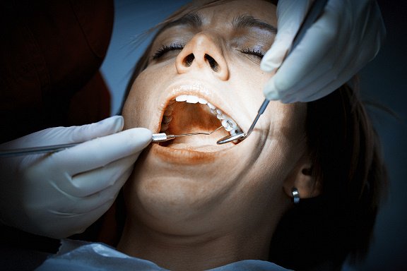 Vitalityedin's tweet photo. Will I Need a Root Canal?
https://t.co/TH4rh4WsIR   #teeth #dentalhealth #smile #dentist #oralhealth https://t.co/gKVzPf73Ng