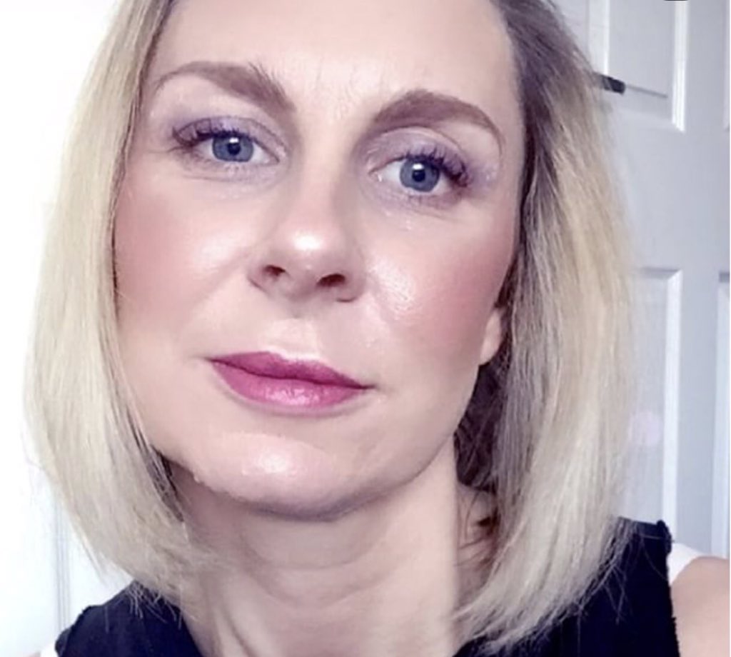 A stunning before and after result using #dermalrevolution DEEP on the nasolabial fold. By a v talented practitioner - lulucosmetics.setmore.com #dermalfiller #fillers #fillervolume #aesthetics