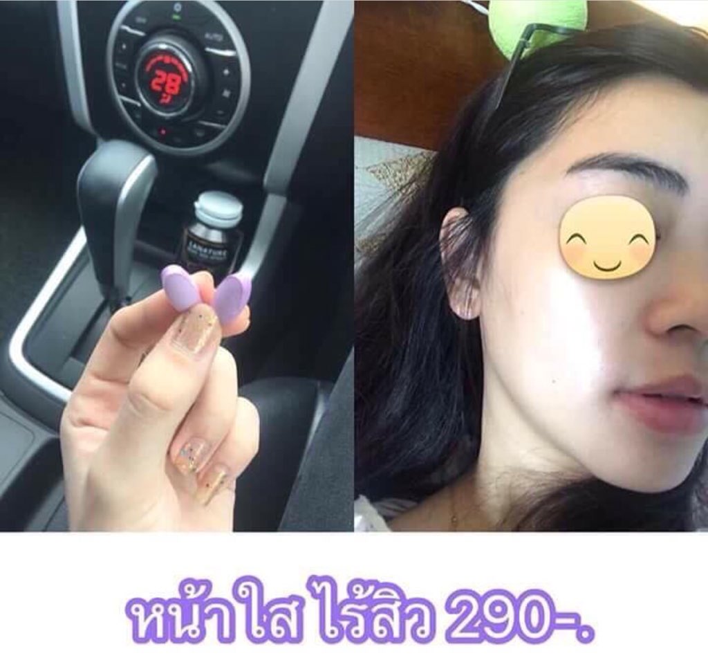 dwplus888's tweet image. เม็ดม่วง #Grapeseed แม่งดีจริง  ทานไป1 กระปุก หน้าใส สิวหาย  ของดีและถูกต้องบอกต่อ  ไม่อยากหน้าใสคนเดียว ใครเป็นสิวอยากจะแนะนำ #howtopefect  #O2soSTRONG