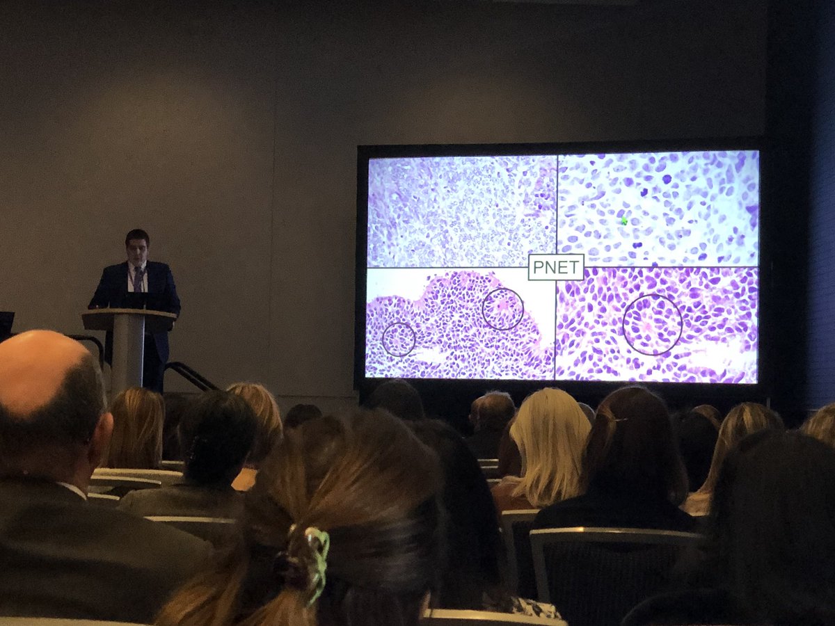 SunnyKaoMD's tweet photo. Dr.Magers from IU presenting a GU platform on testicular PNETs!! #IUpath #USCAP2018 #GUPath https://t.co/e94kgklk7k