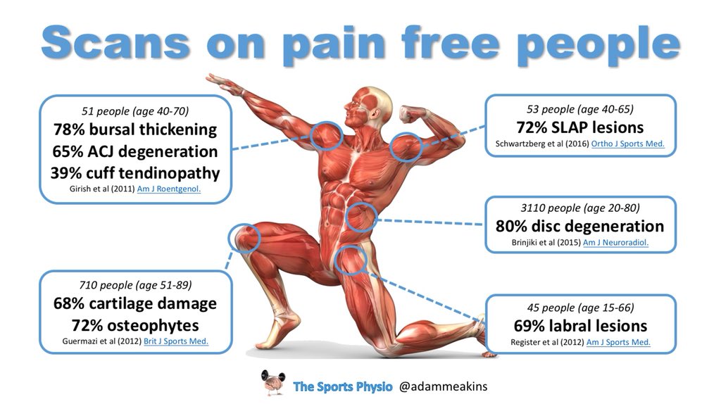 More healthcare professionals need to realise that things seen on scans in those that hurt are often also seen in those that don’t... #NeverTreatAScan