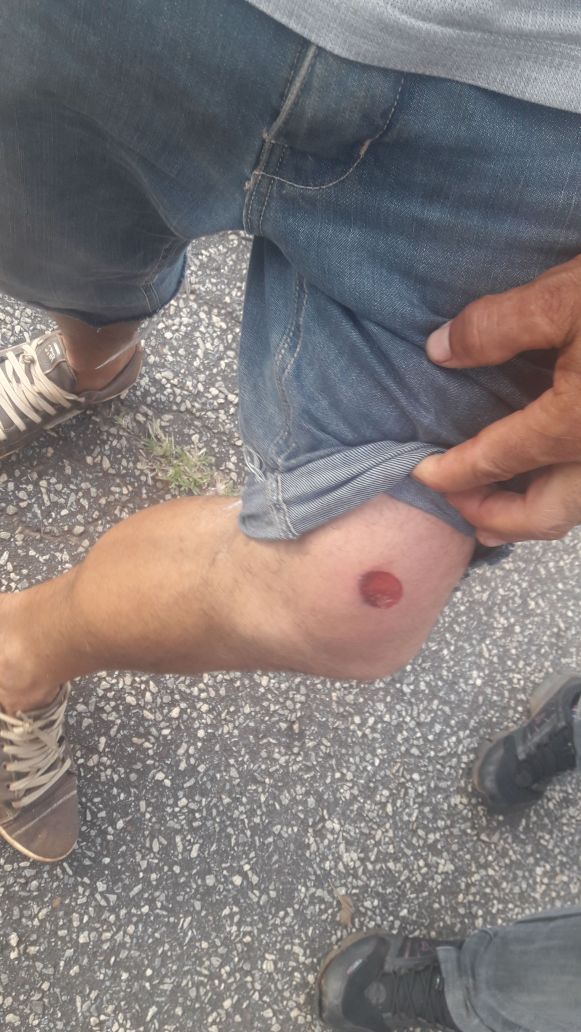 FAMA_2018's tweet photo. 🚨🚨 URGENTE! 
Polícia agride acampados de Itatiaiuçu-MG, em represália à ação das mulheres. As famílias estavam à espera das mulheres, que voltavam da atividade em defesa das águas, na Nestlé, em são lourenço. Confira na íntegra 👉🏿https://t.co/q7OtoM4TTI  #MulheresPelaÁgua https://t.co/UVbjryDfpK