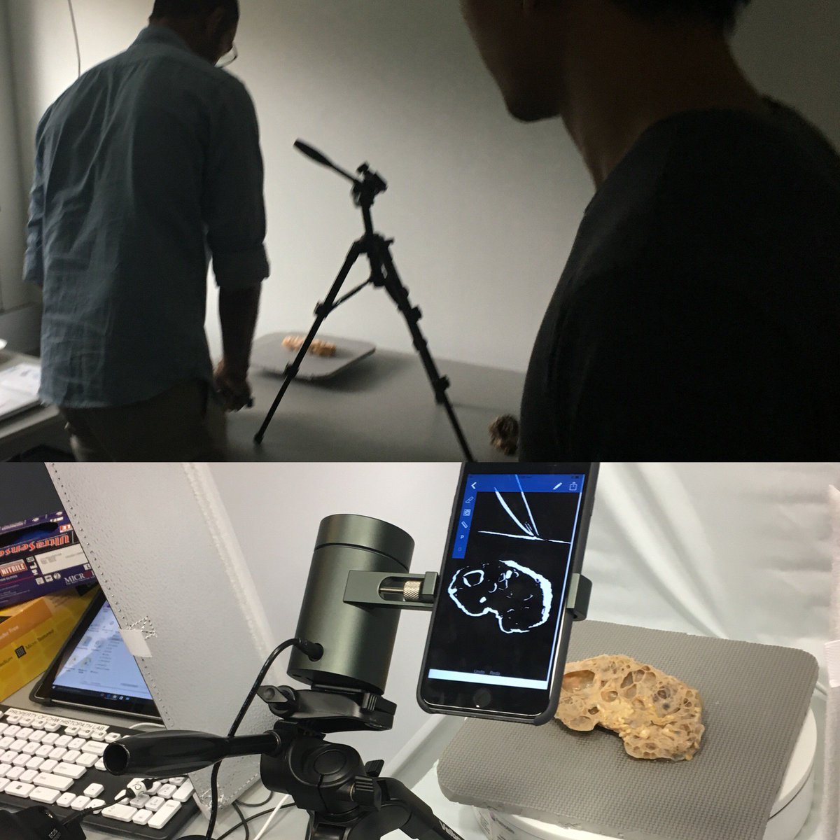 #goodthingsaboutmyjob @diseasemuseum is getting to play with @UNSWEngineering
alumni @eora3D 's new #3D #scanner. Here with a #poly-cystic #kidney specimen #museum #disease #health #medicine #education #museumed #STEM 
@NaliniPather @UNSWMedEdGroup @LITEroomUNSW @BEST_medical