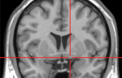 KingsIoPPN's tweet photo. A method to predict which #Parkinsons patients will start to develop #dementia, before they show any symptoms, has been identified by @PolitisNIG at @KingsCollegeLon 

Read more: https://t.co/h1jImy12R5

@Brain1878 https://t.co/A9kqTMIJfX