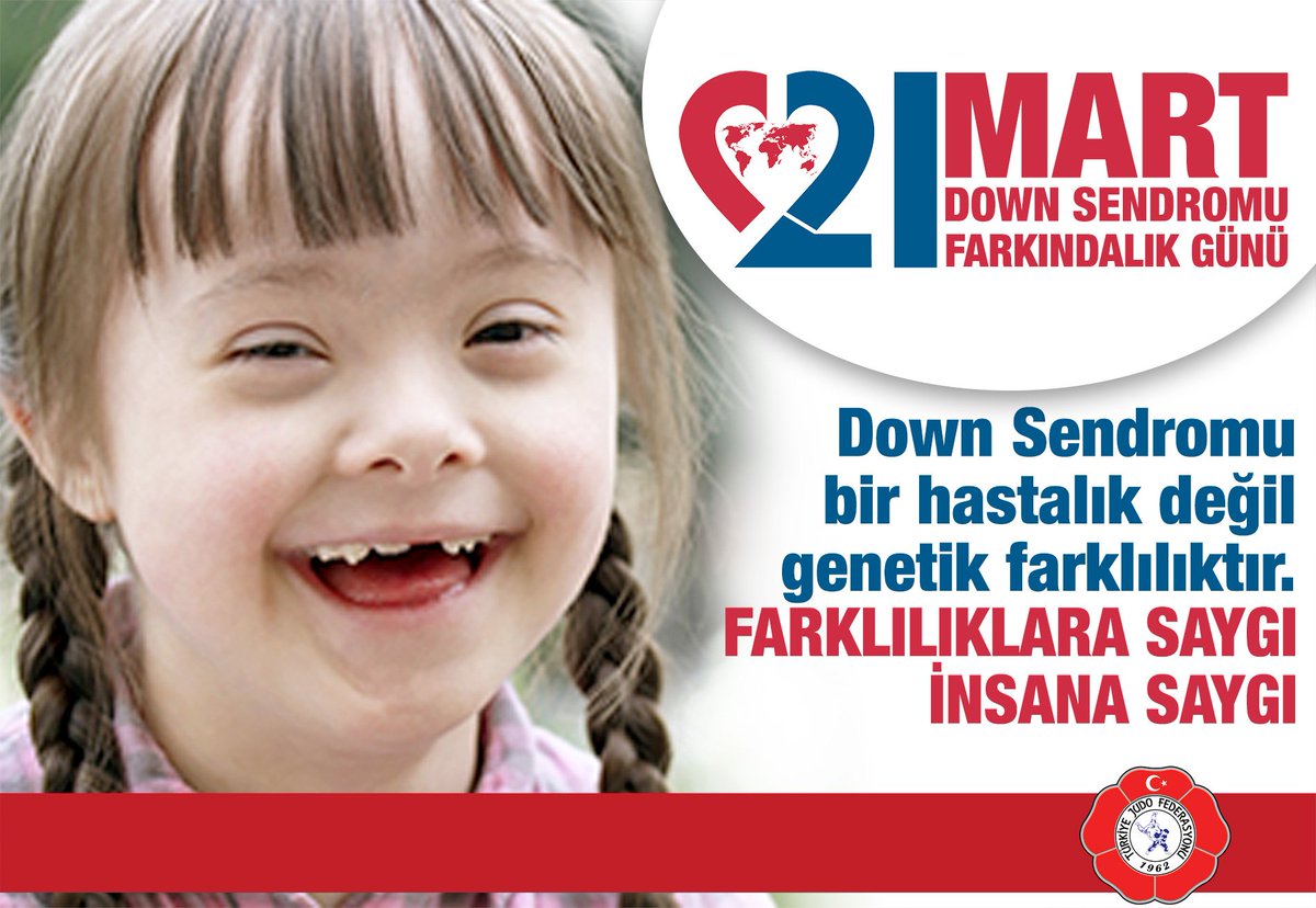 Down sendromu nedir Down sendromu nedir