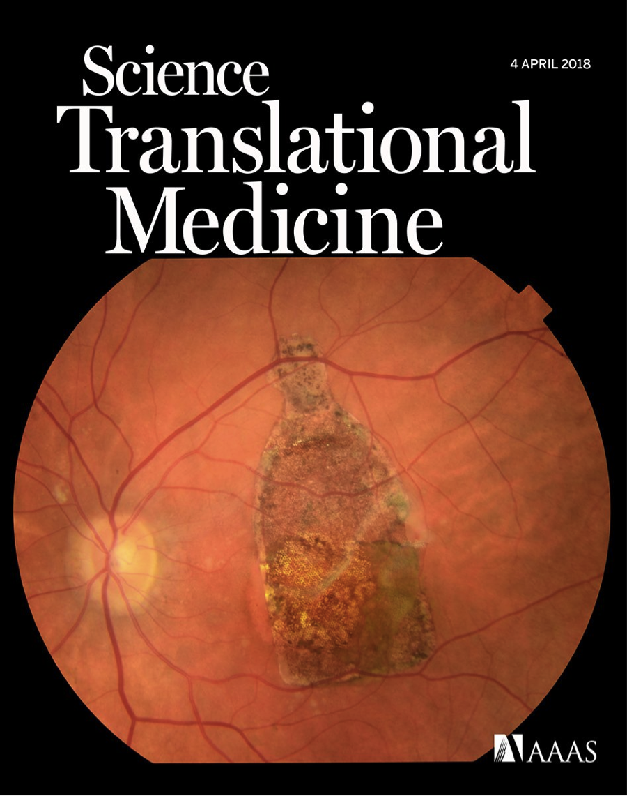 uscibt's tweet photo. #USCIBT and #USCeye investigators report encouraging results from first-in-kind stem cell-based clinical trial for dry AMD. https://t.co/27eYDjvOlT 
Featured as cover story #ScienceTM #CIRM https://t.co/Ocnof8Fyd8