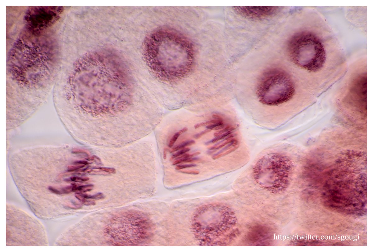 ごうぎ しげる 玉ねぎの根の体細胞分裂の様子 リベンジ版 これもサフラニンｏで染色していますが なかなかいい感じに染色できました １００倍の対物レンズ 油浸 で撮影しています 参考にした観察方法はyoutubeの方に記述しています