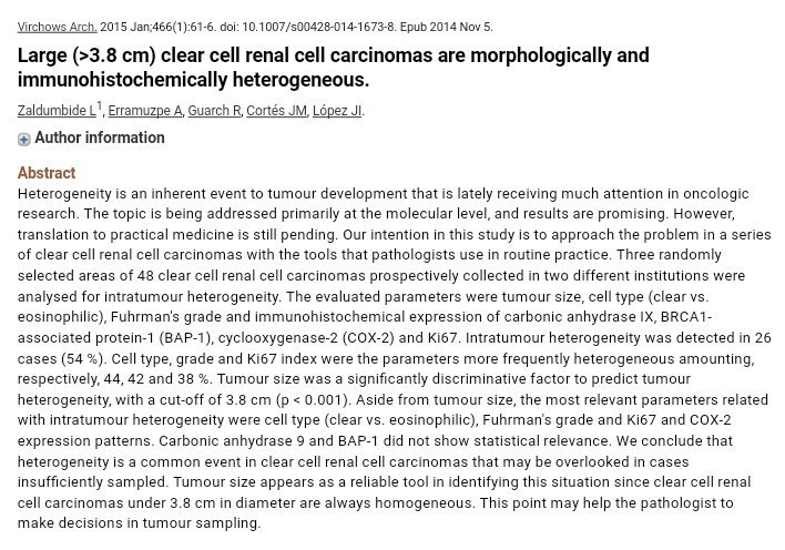 edusqo's tweet photo. Heterogeneidad en #Cáncer de Riñón en #DestapaSEAP "Large (>3.8 cm) clear cell renal cell carcinomas are morphologically and immunohistochemically heterogeneous" #GUPath #MatchingLearning #AI #DigitalPathology #PatologíaDigital https://t.co/GkuNmdyemJ