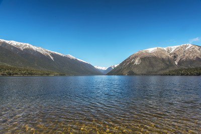 PRNewswireIL's tweet image. #Algatech Invests in #Supreme #Health ow.ly/FaVg30jhN6t