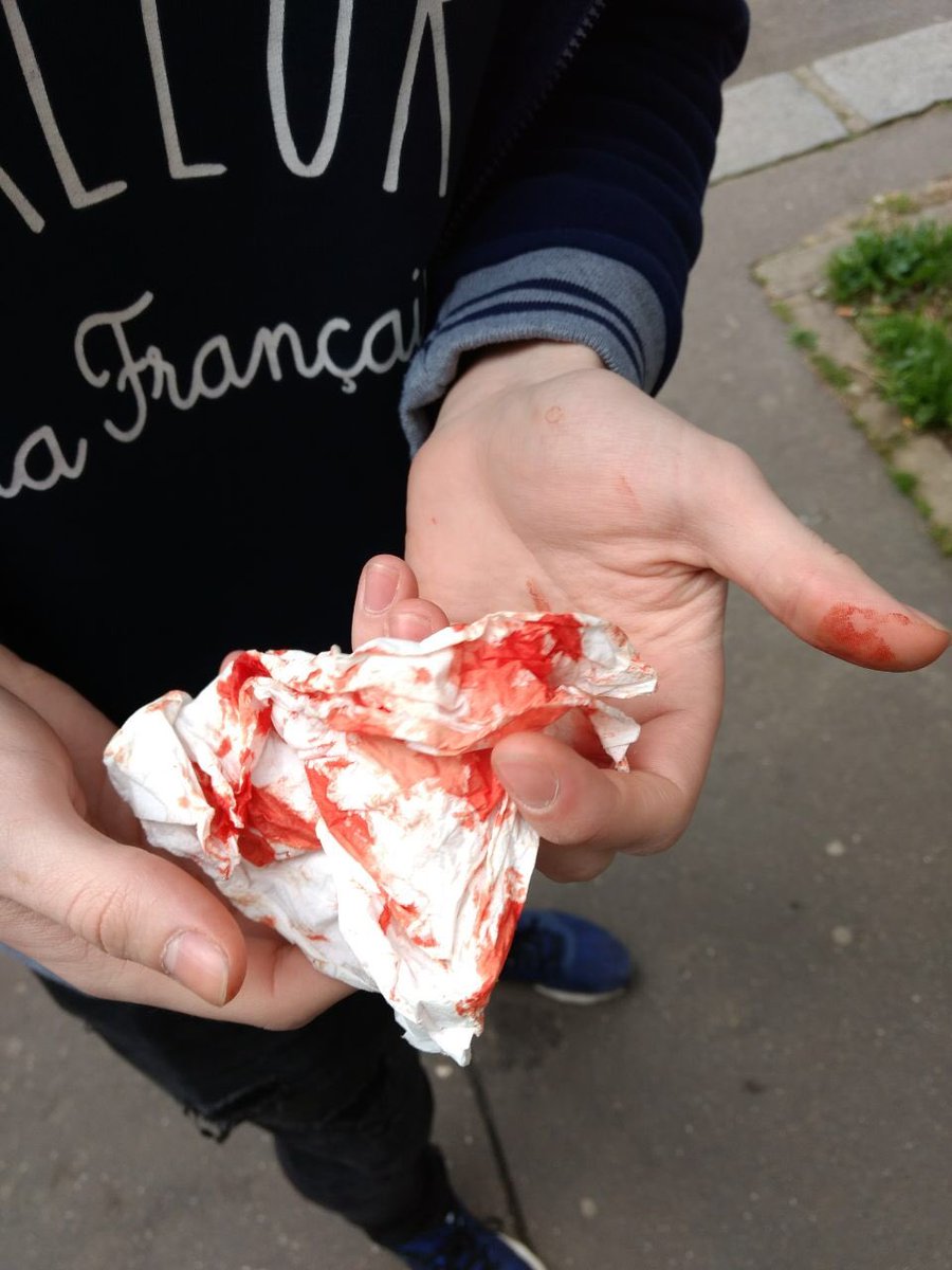 CocardeEtud's tweet photo. Ce matin nos militants tractaient pacifiquement contre le blocus à Tolbiac( @SorbonneParis1 )
Au bout de 5 minutes des militants d’extrême gauche sont venus, les ont agressés et l’un des nôtres a été roué de coups à 15 contre 1 au sol.
Qui réagira? Qui en parlera? https://t.co/YEehmc678k