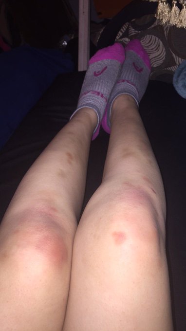 Work beat me up today, spending the next hour on cam, then epsom salt bath and bedtime for me https://t<a href="/tag/mvsales"class="tags"><span>#mvsales</span></a>