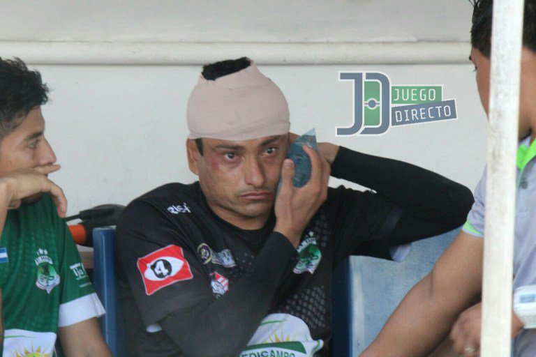 LMF_Magazine's tweet photo. #Clausura2018
#MemeGonzález fue ingresado nuevamente en un hospital de San Miguel tras el golpe de la cabeza que sufrió en el juego vs @CDeportivoFAS. El portero de @CDDragonSV no jugará contra Pasaquina el día de mañana.

#ApoyemosLoNuestro 
#DRAPAS https://t.co/Mu1mhYJvmz