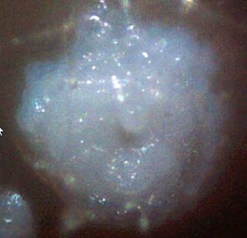 大沼安史 ２０２０ ６ ２２帰幽 Pa Twitter ケムトイレル情報 カーニコム研究所 ケムトイレルを培養すると 左側の写真にように 粉空の下 滋賀県湖南市に住む小生の 申し訳ありませんが 白い粘着質の痰 ところどころが白いメタリックな粒 円内