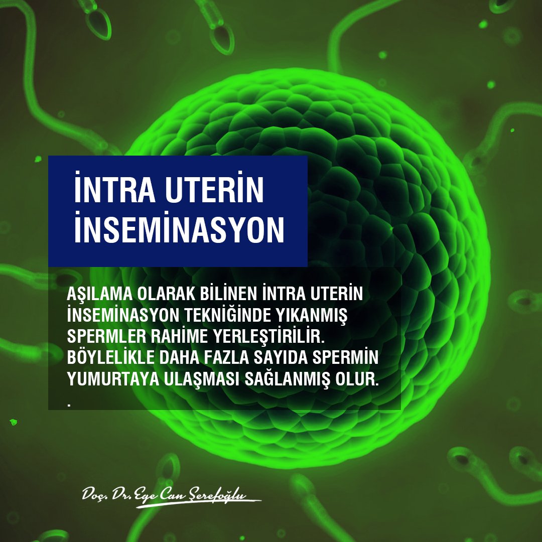 drserefoglu's tweet photo. #aşılama #intrauterin #inseminasyon #drserefoglu https://t.co/5GNUxVrCOp