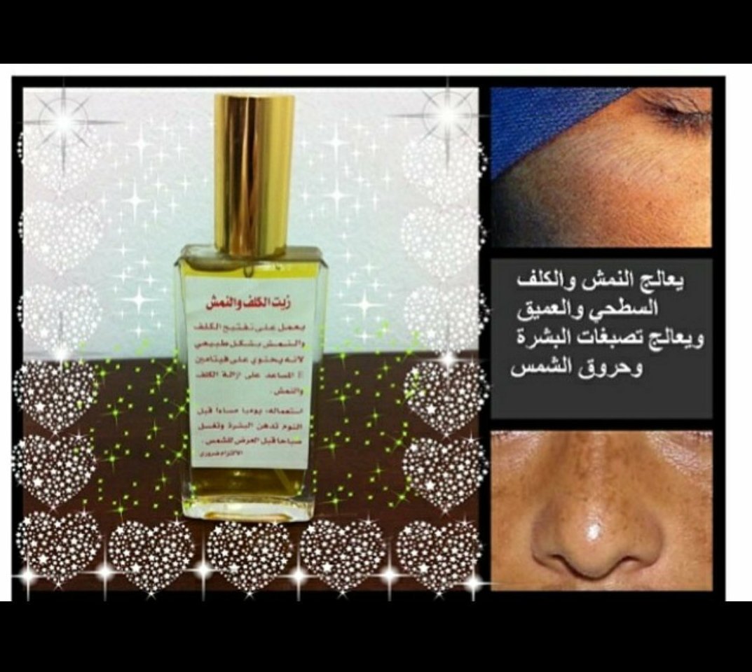 teptep20's tweet photo. علاج الكلف والنمش   
للتواصل واتس
00966559113982 https://t.co/cXp5mtL3Zb