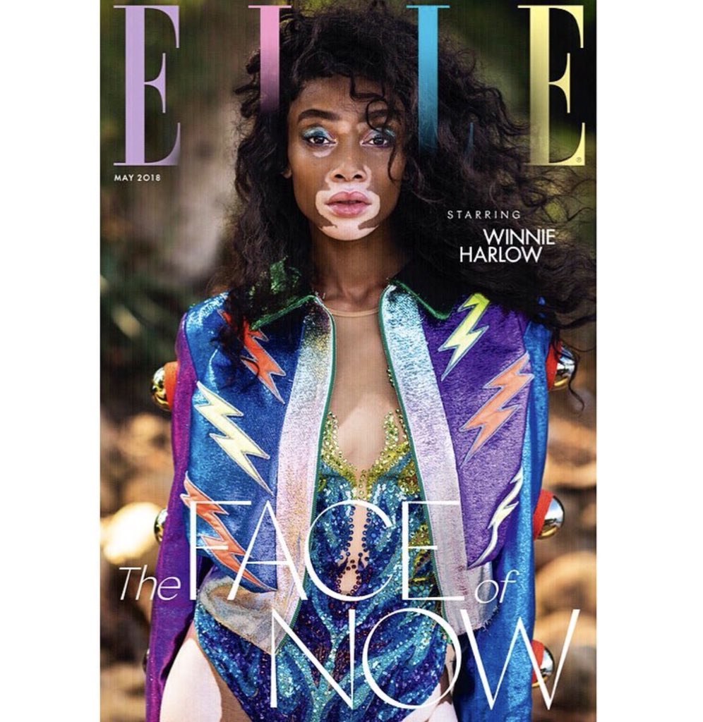 ‘What makes you different, makes you beautiful.’

Ultimate #womencrushwednesday this months <a href="/ELLEUK/">ELLEUK</a> cover girl <a href="/winnieharlow/">♔Winnie Harlow♔</a> 😍😍

#beautiful #covergirl #coverstar #wcw #wednesdayswomen #elle #elleuk #ellemagazine #beauty #winnieharlow #beauty #fashion #style #gucci