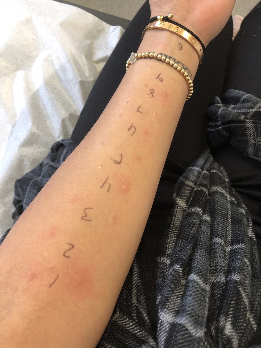 laurDIY's tweet photo. when ur allergic to basically everything https://t.co/wB7RKLVksU