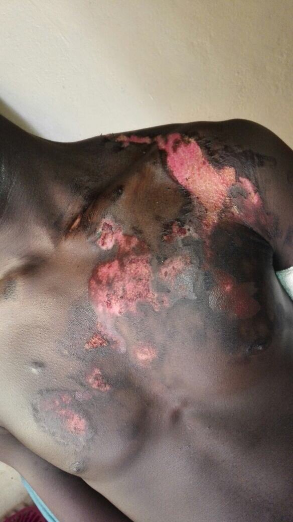 SofasonkeMpanza's tweet photo. The owner of @RodizioBrazilia in Fourways poured boiling water on employee &amp; we expected to keep quiet?Cause reconciliation is sacrosanct? https://t.co/KD1EaPROQZ