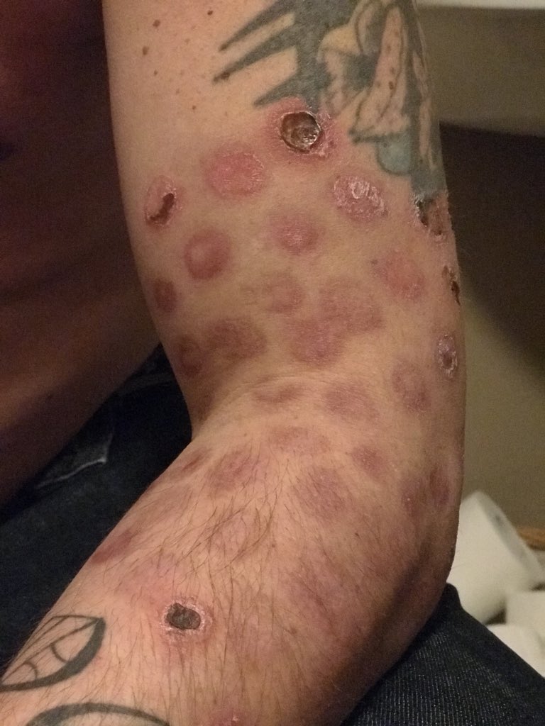 LWDHNM's tweet photo. I can’t afford to donate right now as my husband has been off with serious mental health issues this last year but as soon as I can I will  @sportrelief  I really hope people get help  this isn’t a nice image but this is real life #Selfharm 😢 https://t.co/85BxbNTJoX