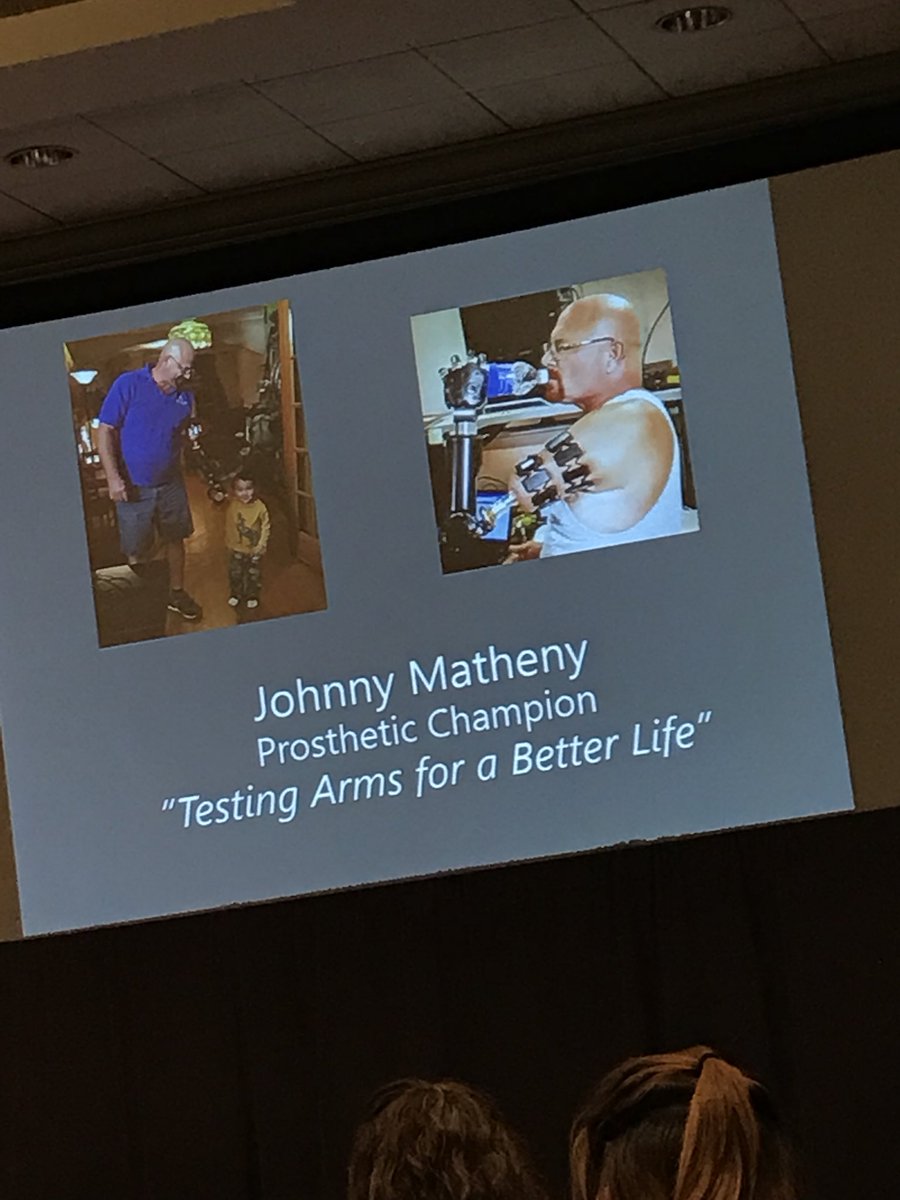 MFamilyMom's tweet photo. Dr. Albert Chi and “prosthetic champion” Johnny Matheny demonstrate an upper extremity prosthetic using targeted muscle reinnervation.  The human body is amazing. #TraumaCon2018 https://t.co/0xkXlU3eIg