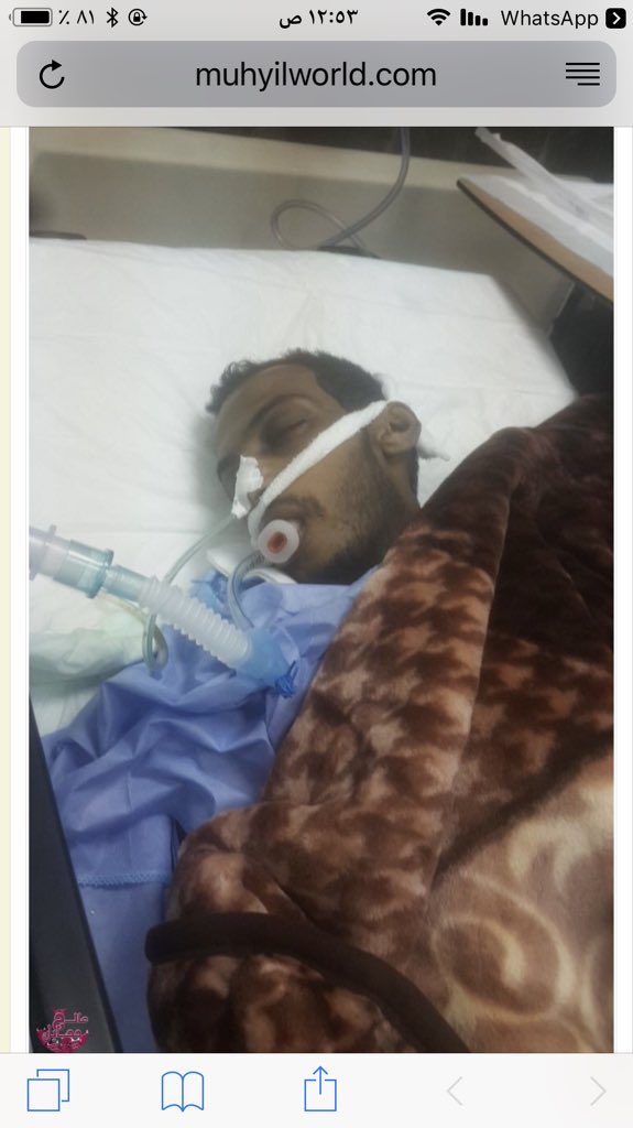 <a href="/fayez_malki/">فايز المالكي</a>  اخوي فايز إنت سبب بعد الله يوجد شخص بحاجه ماسه للمساعده ولايكلف الكثير فقط يحتاج لنقله من مستشفى عسير الى المستشفى التخصصي بالرياض هالانسان يشهد له بفعل الخير لمن مرض محد ساعده وهو بين الحياة والموت(فادي الحلوي)اسال الله له الشفاء العاجل.