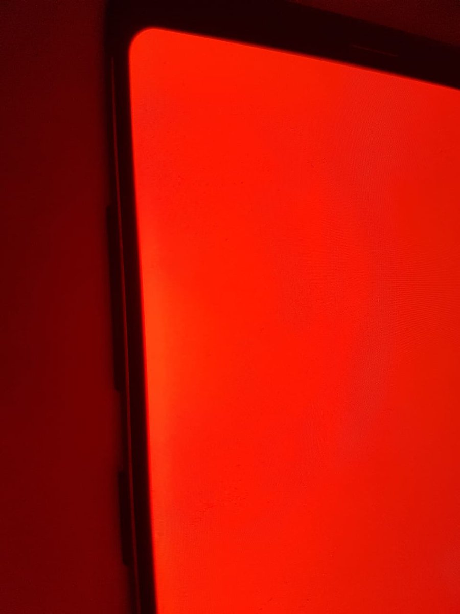 mr_byri's tweet photo. @Samsung_IN @SamsungMobile this is what i get the feedback from your service executives. Saying no defect in the phone as you can see what is the problem with my note 8. They are afraid to say it's a normal phenomenon in email and in call they say it's a normal phenomenon. https://t.co/qtWUvOuL6s