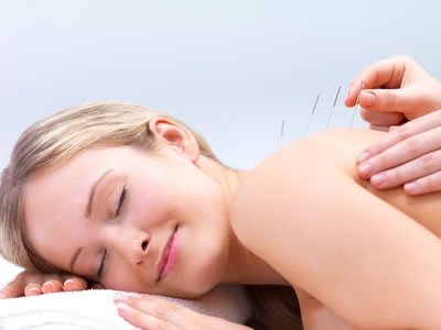Acupuncture can be one of the best treatments for treating infertility and for offering that service you will find Essential Wellbeing by your side. #Acupuncturist #NewZealand Call : (08) 8352 3100
