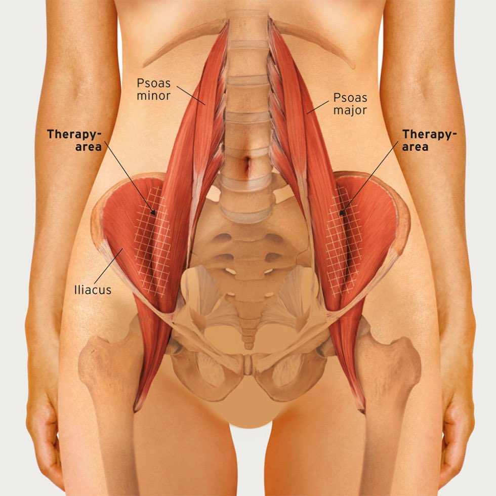 proosetherapy's tweet image. A weak or tight Psoas muscle can cause lower &amp;amp; upper back, knee and neck pain. Call us on 01745 341781 or visit our www. #backpain #sportstherapy #kneepain