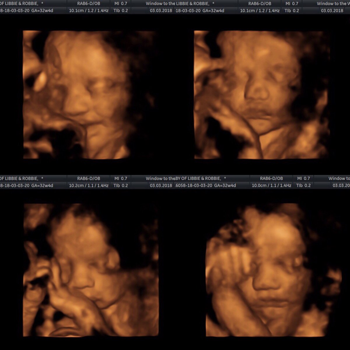 liblibdeluca's tweet image. you’re so loved already baby girl👑 mummy can’t wait to meet you💗