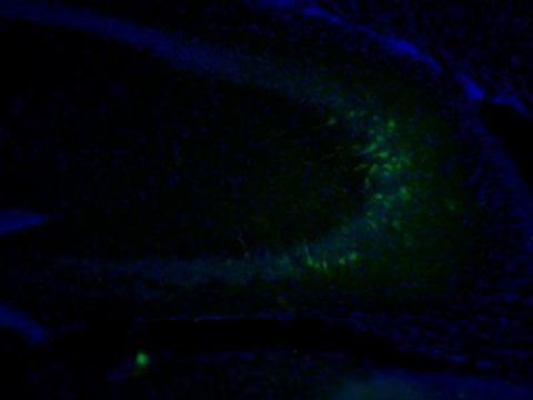 29thNeurosci's tweet image. Early life experiences influence #DNA in the #adultbrain
Salk scientists discover how maternal #behaviorchanges  #braincells in mice
More details visit:…gnitivedisorders.conferenceseries.com
childhood environments affect #brain in humans and  provide insights into #depression , #schizophrenia.