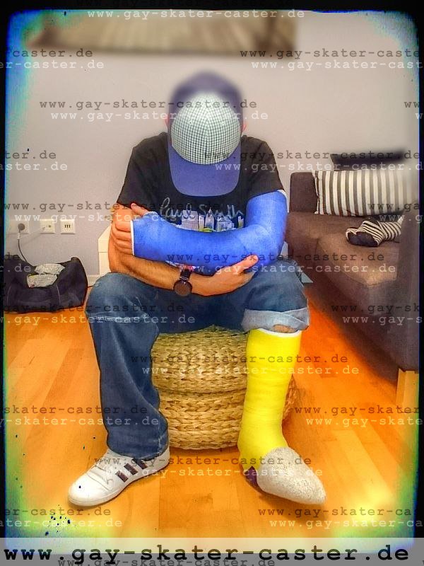 GaySkaterCaster's tweet photo. 2015-11 slwc lac

Got a #yellow short leg walking cast and a #blue full arm cast. Could hardly walk in this #slwc with #walkingheel and a #toeplate to protect my long toes. thick and heavy #fibercast being completely immobilised

24 Mar 2018: video added

https://t.co/cb4S5U0fnN https://t.co/nZi9fLxgrR